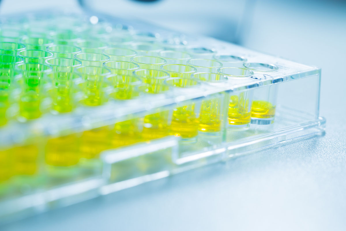 A clear 96-well laboratory plate in close focus, with green and yellow liquid samples in its wells